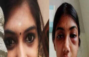 ಅತ್ತೆಯ ಅನೈತಿಕ ಸಂಬಂಧ ಬಯಲು ಮಾಡಿದ ಸೊಸೆ ಮೇಲೆ ಮಾರಣಾಂತಿಕ ಹಲ್ಲೆ