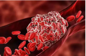 ಹಿಮೋಗ್ಲೋಬಿನ್ ಹೆಚ್ಚಳಕ್ಕೆ ಈ ಆಹಾರಗಳು ಬೆಸ್ಟ್