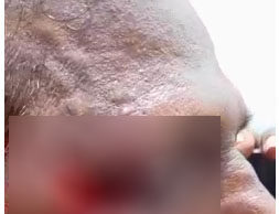 ಗುಂಡ್ಲುಪೇಟೆ: ರೈತನ ಮೇಲೆ ಹುಲಿ ದಾಳಿ- ಗಂಭೀರ ಗಾಯ