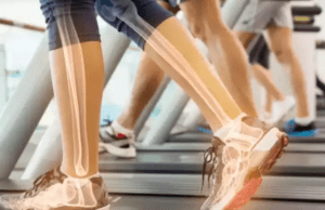 ಮೂಳೆಗಳ ಆರೋಗ್ಯಕ್ಕೆ ಮುಖ್ಯವಾಗಿರುವ ಕ್ಯಾಲ್ಸಿಯಂಗಾಗಿ ಈ ಆಹಾರ ಸೇವಿಸಿ