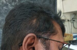 ಕರಾಮುವಿ ಕುಲಪತಿ ಮೇಲೆ ಹಲ್ಲೆ ಆರೋಪ