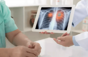 ಶ್ವಾಸಕೋಶ ಆರೋಗ್ಯದಿಂದಿರಲು ಈ ಆಯುರ್ವೇದ ಮೂಲಿಕೆಗಳು ಉತ್ತಮ