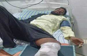 ಪೊಲೀಸರ ಮೇಲೆ ಹಲ್ಲೆಗೆ ಮುಂದಾದ ಆರೋಪಿ ಕಾಲಿಗೆ ಗುಂಡೇಟು