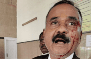 ಚೆಕ್ ಬೌನ್ಸ್ ಪ್ರಕರಣ: ವಕೀಲ ಕೃಷ್ಣಾರೆಡ್ಡಿ ಮೇಲೆ ಚಾಕುವಿನಿಂದ ದಾಳಿ ನಡೆಸಿದ ಆರೋಪಿ ಮಹಿಳೆ; ಪ್ರಕರಣ ದಾಖಲು