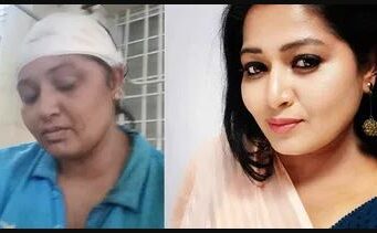 ಚಲನಚಿತ್ರ ನಟಿ ಅನುಗೌಡ ಮೇಲೆ ಮಾರಣಾಂತಿಕ ಹಲ್ಲೆ: ದೂರು ದಾಖಲು