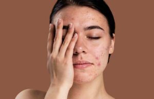 ಚರ್ಮರೋಗ