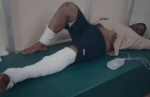 ಜಮೀನಿನಲ್ಲಿ ಕೆಲಸ ಮಾಡುತ್ತಿದ್ದ ರೈತರ ಮೇಲೆ ಕಾಡು ಹಂದಿ ದಾಳಿ: ಇಬ್ಬರಿಗೆ ಗಂಭೀರ ಗಾಯ