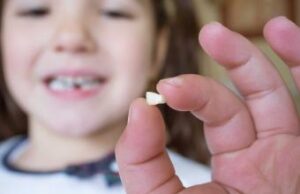 ಹಲ್ಲಿನ ಸಮಸ್ಯೆಗಳು