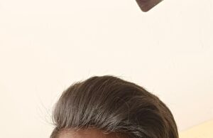 ಅಪಘಾತದಲ್ಲಿ ಮೆದುಳು ನಿಷ್ಕ್ರಿಯ: ಅಂಗಾಂಗ ದಾನ ಮಾಡಿ ಸಾವಿನಲ್ಲೂ ಸಾರ್ಥಕತೆ ಮೆರೆದ ಯುವಕ