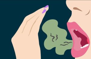 ಬಾಯಿಯ ದುರ್ಗಂಧ ನಿವಾರಣೆಗೆ ಮನೆ ಮದ್ದು