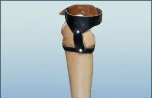 ರೋಟರಿಯಿಂದ ವಿಕಲಚೇತನರಿಗೆ ಉಚಿತ ಕೃತಕ ಕಾಲು ವಿತರಣೆ