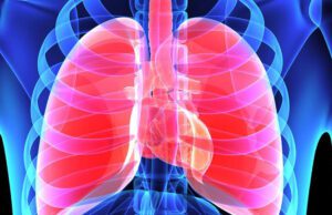 ಲೋಯರ್ ರೆಸ್ಪಿರೇಟರಿ ಟ್ರ್ಯಾಕ್ಟ್ ಇನ್ಫೆಕ್ಷನ್