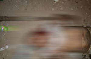 ಮಂಡ್ಯ: ನಾಯಿಗಳ ದಾಳಿಗೆ ವೃದ್ಧ ಬಲಿ