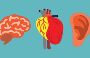 ಡೌನ್ ಸಿಂಡ್ರೋಮ್ :-