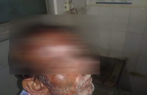 ಕೆ.ಆರ್.ಪೇಟೆಯಲ್ಲಿ ರೈತನ ಮೇಲೆ ಚಿರತೆ ದಾಳಿ: ಮಾರಣಾಂತಿಕ ಗಾಯ