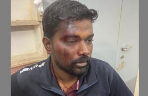 ಶಿವಮೊಗ್ಗ: ಬಿಜೆಪಿ ಕಾರ್ಯಕರ್ತನ ಮೇಲೆ ಹಲ್ಲೆ