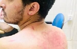 ಹೆಲ್ಮೆಟ್ ಧರಿಸದ ಯುವ ವಕೀಲನ ಮೇಲೆ ಹಲ್ಲೆ: ಚಿಕ್ಕಮಗಳೂರು ಪಿಎಸ್ ಐ ಸೇರಿದಂತೆ ಆರು ಪೊಲೀಸರ ಅಮಾನತು