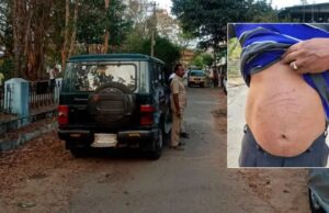 ಶಿವಮೊಗ್ಗದಲ್ಲಿ ಕರಡಿ ದಾಳಿ: ವ್ಯಕ್ತಿಗೆ ಗಾಯ