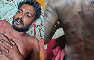 ರಾಮನಗರ: ಬಿಜೆಪಿ ಪರ ಮತಯಾಚನೆ ಮಾಡಿದ್ದಕ್ಕೆ ವ್ಯಕ್ತಿ ಮೇಲೆ ಹಲ್ಲೆ