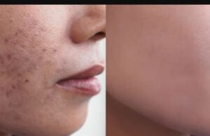 ಕಲೆಗಳ ಮುಖ