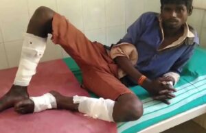 ಕೋಲಾರ: ಶ್ರೀಗಂಧದ ಮರ ಕಳವಿಗೆ ಬಂದಿದ್ದವರ ಮೇಲೆ ಫೈರಿಂಗ್