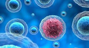 ಕ್ಯಾನ್ಸರ್