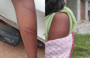 ವಿದ್ಯಾರ್ಥಿನಿಗೆ ಬಾಸುಂಡೆ ಬರುವಂತೆ ಹೊಡೆದ ಪ್ರಾಂಶುಪಾಲೆ: ಪೋಷಕರ ಕಿಡಿ