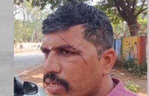 ಪೊಲೀಸ್ ಪೇದೆ ಮೇಲೆ ಕೈ ಮುಖಂಡ ತಮಟಗಾರ ಸಹೋದರ ಬ್ಲೇಡ್ ನಿಂದ ಹಲ್ಲೆ