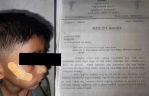 ಹಾವೇರಿ: ಗಾಯಕ್ಕೆ ಹೊಲಿಗೆ ಹಾಕುವ ಬದಲು ಫೆವಿಕ್ವಿಕ್ ಹಾಕಿದ ಸರ್ಕಾರಿ ಆಸ್ಪತ್ರೆ ನರ್ಸ್