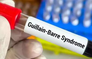 GB ಸಿಂಡ್ರೋಮ್: ಆಂಧ್ರಪ್ರದೇಶದಲ್ಲಿ ಇಬ್ಬರ ಸಾವು, ಸೋಂಕಿತರ ಸಂಖ್ಯೆ 17