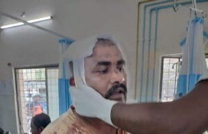 ಮದ್ದೂರು: ಗ್ರಾ.ಪಂ. ಸದಸ್ಯನ ಮೇಲೆ ಹಲ್ಲೆ