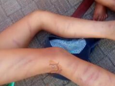 ಹೋಂವರ್ಕ್ ಮಾಡದ ಮಗುವಿಗೆ ನೂರವೈತ್ತು ಬಾರಿ ಥಳಿಸಿದ ಶಿಕ್ಷಕ