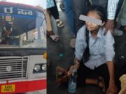 ವಿದ್ಯಾರ್ಥಿನಿ ಕಾಲಿನ ಮೇಲೆ ಹರಿದ ಬಸ್ ಟೈರ್ – ಕಾಲು ಮುರಿತ