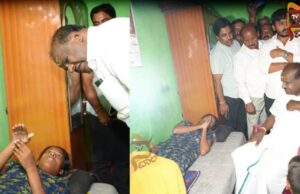 ಬರೋಬ್ಬರಿ 11 ಶಸ್ತ್ರಚಿಕಿತ್ಸೆ – ಯುವತಿ ಸ್ಥಿತಿ ಕಂಡು ಮರುಗಿದ ಹೆಚ್ಡಿಕೆ