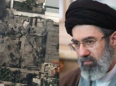 ಸುಟ್ಟು ಹೋಗಿದೆ ತುಟಿ, ಮುಖಕ್ಕೆ ಗಾಯ – ಮೊಜ್ತಾಬಾ ಖಮೇನಿಗೆ ಪ್ಲಾಸ್ಟಿಕ್ ಸರ್ಜರಿ..!