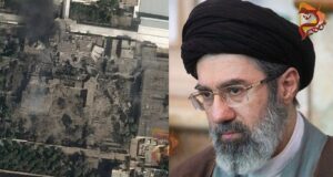 ಸುಟ್ಟು ಹೋಗಿದೆ ತುಟಿ, ಮುಖಕ್ಕೆ ಗಾಯ – ಮೊಜ್ತಾಬಾ ಖಮೇನಿಗೆ ಪ್ಲಾಸ್ಟಿಕ್ ಸರ್ಜರಿ..!