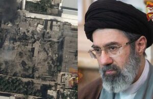 ಸುಟ್ಟು ಹೋಗಿದೆ ತುಟಿ, ಮುಖಕ್ಕೆ ಗಾಯ – ಮೊಜ್ತಾಬಾ ಖಮೇನಿಗೆ ಪ್ಲಾಸ್ಟಿಕ್ ಸರ್ಜರಿ..!