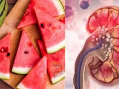 ಬೇಸಿಗೆಯಲ್ಲಿ ಕಲ್ಲಂಗಡಿ ಹಣ್ಣಿನ ಸೇವನೆ ಕಿಡ್ನಿಗೆ ಹಾನಿಕಾರಕವೇ..?