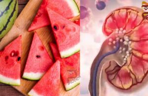 ಬೇಸಿಗೆಯಲ್ಲಿ ಕಲ್ಲಂಗಡಿ ಹಣ್ಣಿನ ಸೇವನೆ ಕಿಡ್ನಿಗೆ ಹಾನಿಕಾರಕವೇ..?