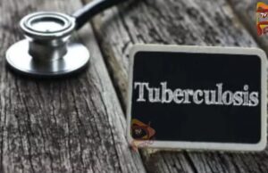 ಮೈಸೂರಿನ 147 ಗ್ರಾ.ಪಂಚಾಯಿತಿಗಳು ‘ಕ್ಷಯ ಮುಕ್ತ ಗ್ರಾಪಂ’ ಎಂದು ಘೋಷಣೆ – ಯಾವ್ಯಾವ ತಾಲೂಕಿನಲ್ಲಿ ಎಷ್ಟು?