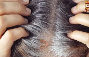 ಚಿಕ್ಕ ಮಕ್ಕಳಲ್ಲಿ ಬಿಳಿ ಕೂದಲು ಕಂಡುಬರುವುದು ಇದಕ್ಕೆ ಕಾರಣ..?