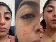 ಕ್ಲಬ್ನಲ್ಲಿ ರಿಯಾಲಿಟಿ ಶೋ ಸ್ಪರ್ಧಿಗೆ ಗಂಭೀರ ಗಾಯ:ಹಲ್ಲು ಮುರಿದು ಮುಖ ಊದಿದ ಸ್ಥಿತಿಯಲ್ಲಿ ಪ್ರೀತ್ ಸಿಂಗ್