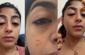 ಕ್ಲಬ್ನಲ್ಲಿ ರಿಯಾಲಿಟಿ ಶೋ ಸ್ಪರ್ಧಿಗೆ ಗಂಭೀರ ಗಾಯ:ಹಲ್ಲು ಮುರಿದು ಮುಖ ಊದಿದ ಸ್ಥಿತಿಯಲ್ಲಿ ಪ್ರೀತ್ ಸಿಂಗ್