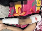 ಬೆಂಗಳೂರು: ಮೂರುವರೆ ವರ್ಷದ ಬಾಲಕಿ ಮೇಲೆ ಬೀದಿ ನಾಯಿಗಳ ದಾಳಿ; ನಾಯಿ ಹಿಡಿಯುವ ಕಾರ್ಯಾಚರಣೆ ಆರಂಭ